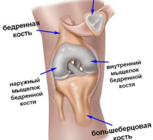 Болезнь Гоффа: симптомы, диагностика и лечение