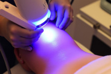 Лазерная эпиляция: что действительно нужно знать перед первой процедурой