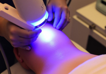 Лазерная эпиляция: что действительно нужно знать перед первой процедурой