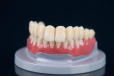 Съемное протезирование зубов: что важно знать прежде чем принять решение