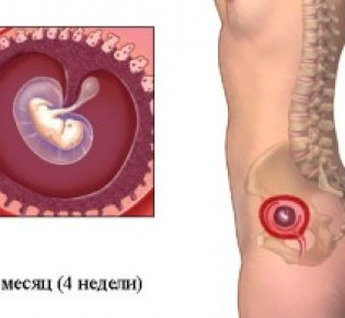 4 неделя беременности