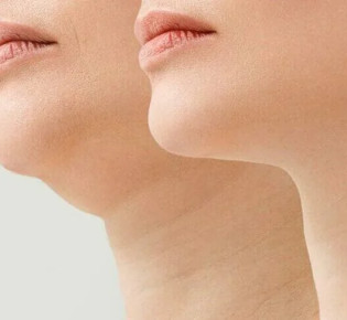 Нет времени на спортзал? ContourSlim сделает тело стройным без усилий!