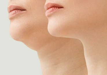 Нет времени на спортзал? ContourSlim сделает тело стройным без усилий!