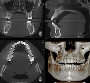 3D Томография челюсти: подробный обзор и важные аспекты