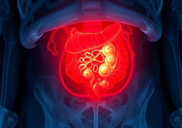 Острый парапроктит: как распознать, что делать и почему не стоит медлить