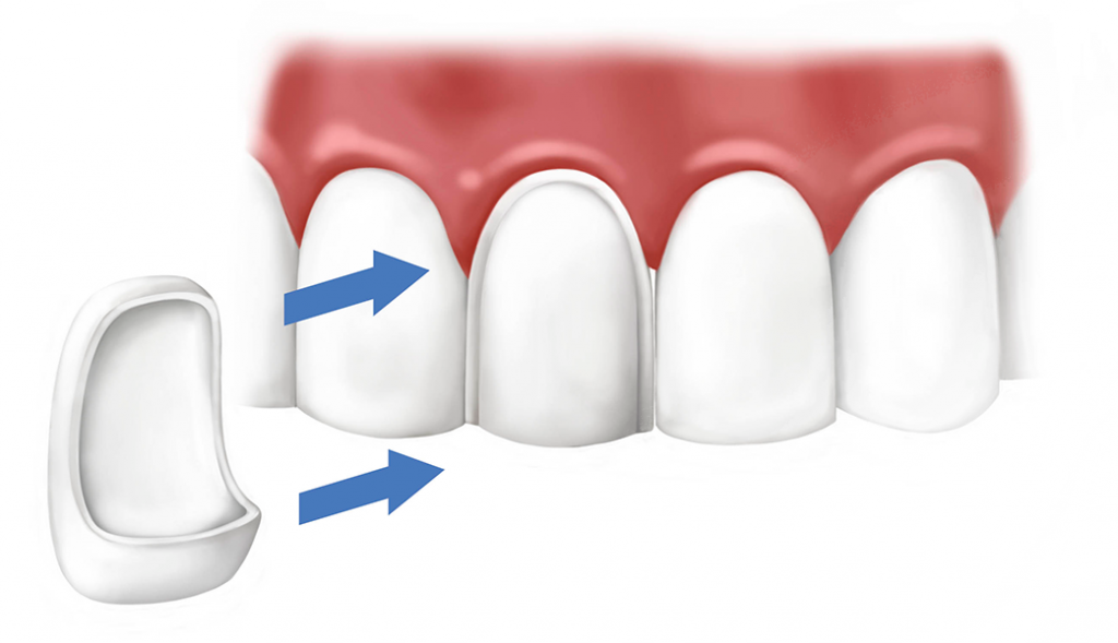 Современные методы лечения зубов