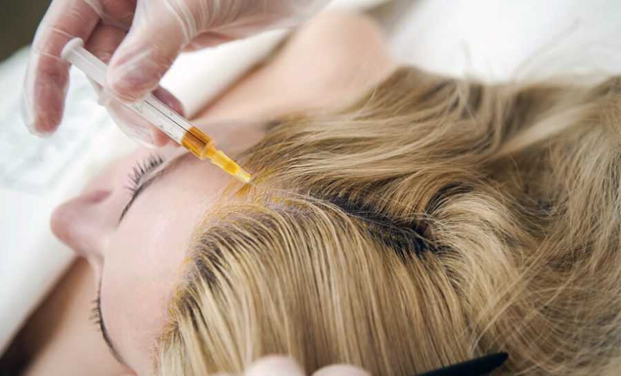 Что такое плазмолифтинг для волос?