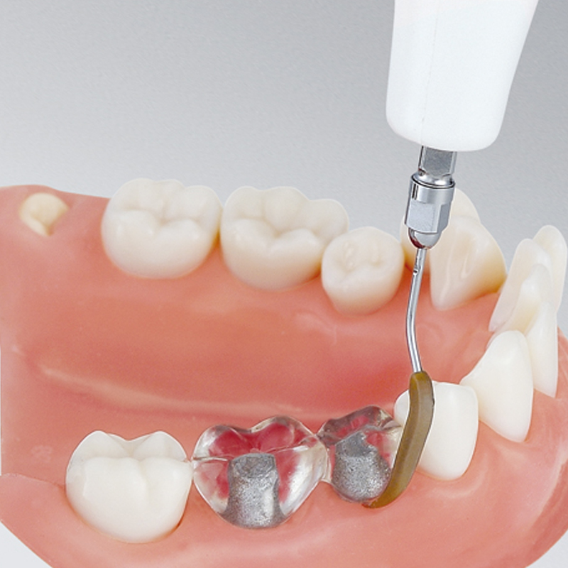 Особенности новых методов протезирования зубов