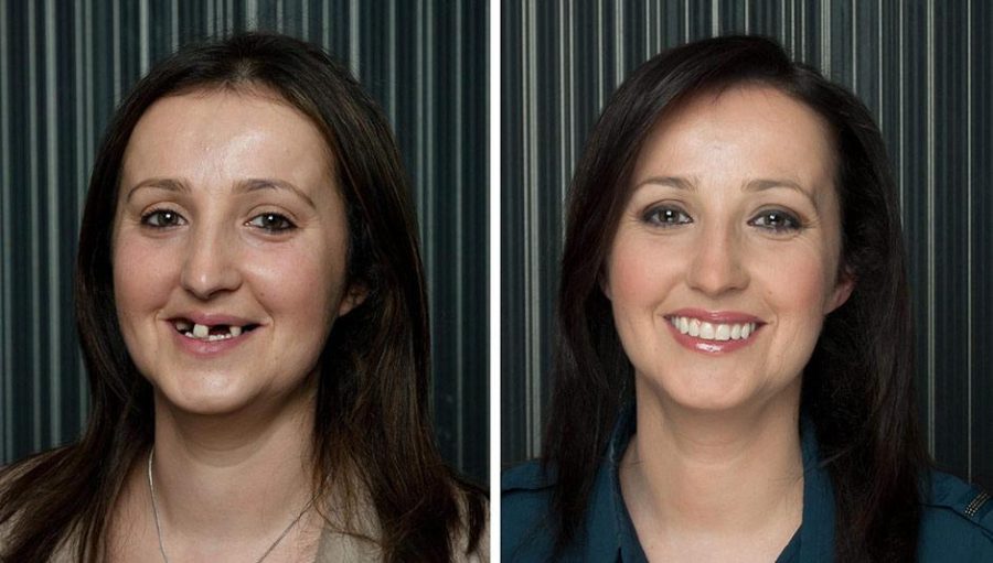 Центр имплантации зубов: восстановление красоты улыбки и функциональности