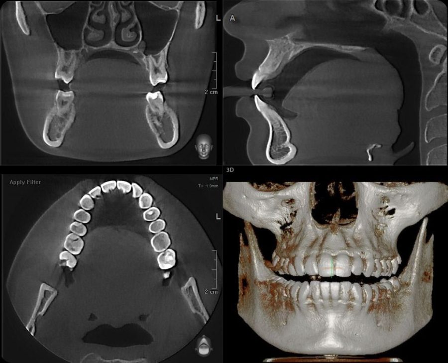 3D Томография челюсти: подробный обзор и важные аспекты
