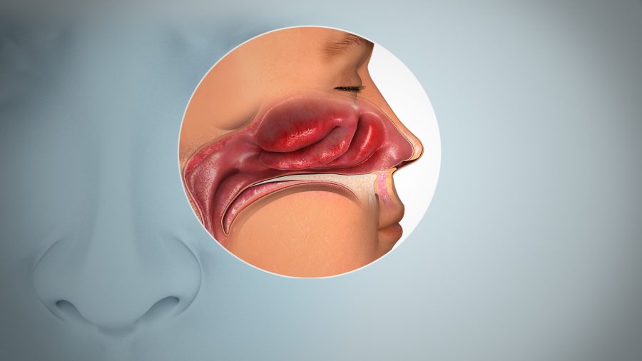 Хроническая заложенность носа: почему это происходит и как справиться с проблемой