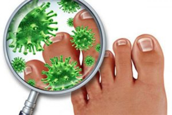 Дерматизон: эффективная мазь в борьбе с грибковыми инфекциями кожи